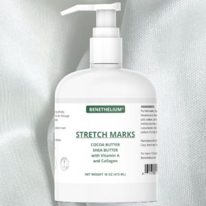 stretch mark cream