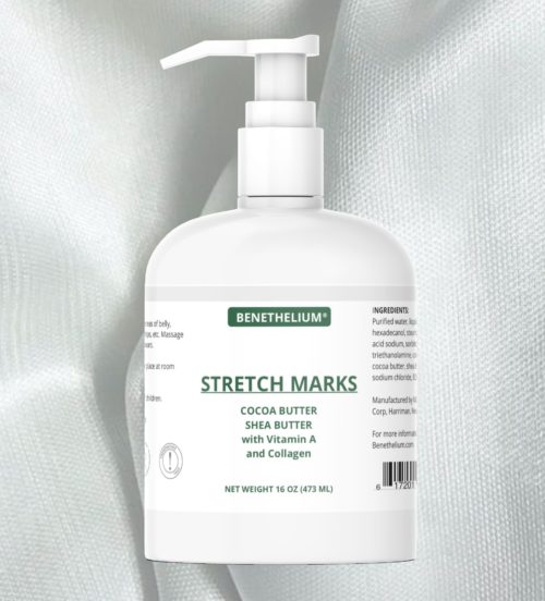 stretch mark cream