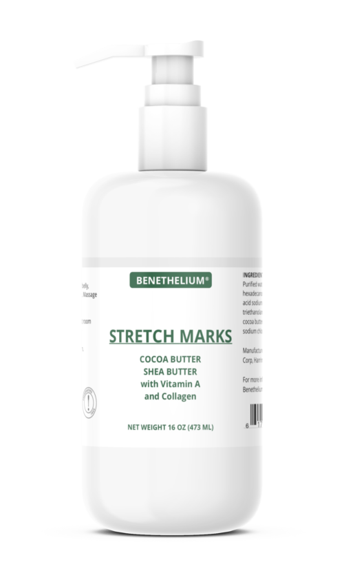 stretch mark cream