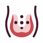 Hemorrhoid icon